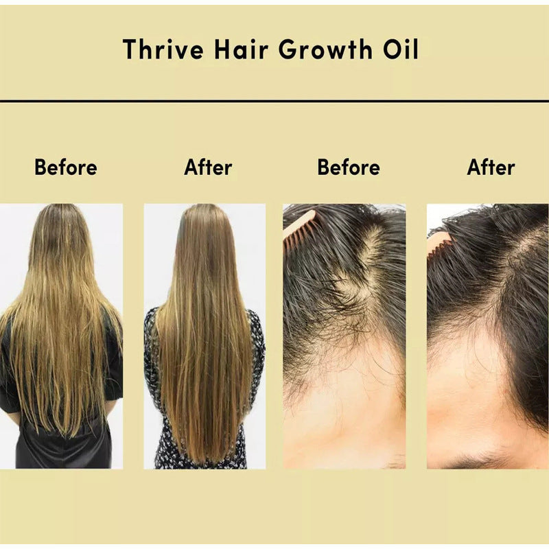 Lush Locks Hair Revitalizer - Radiant Growth Oil