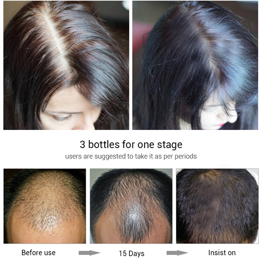 Efero Root-Strengthening Hair Serum